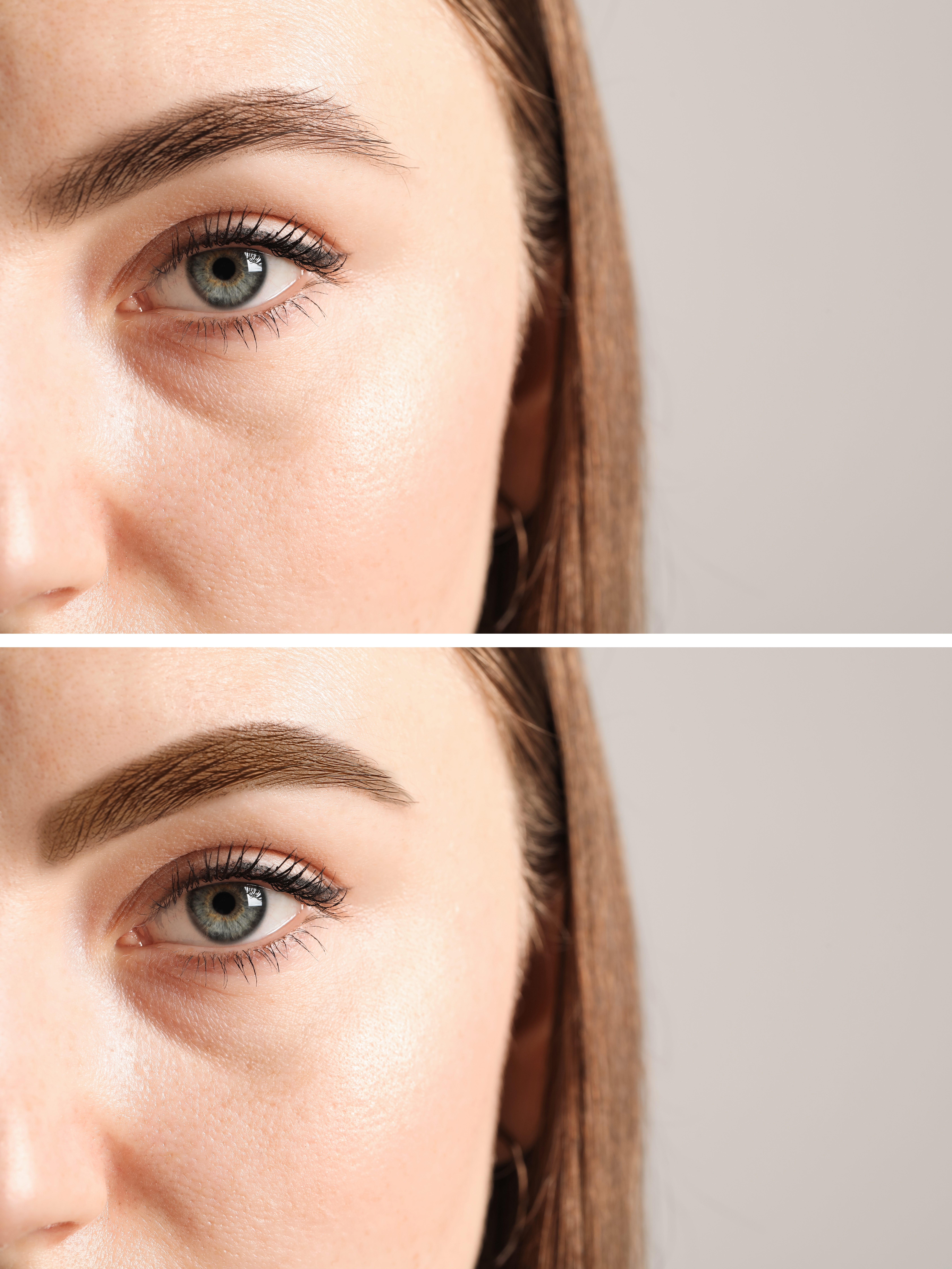 Brow result