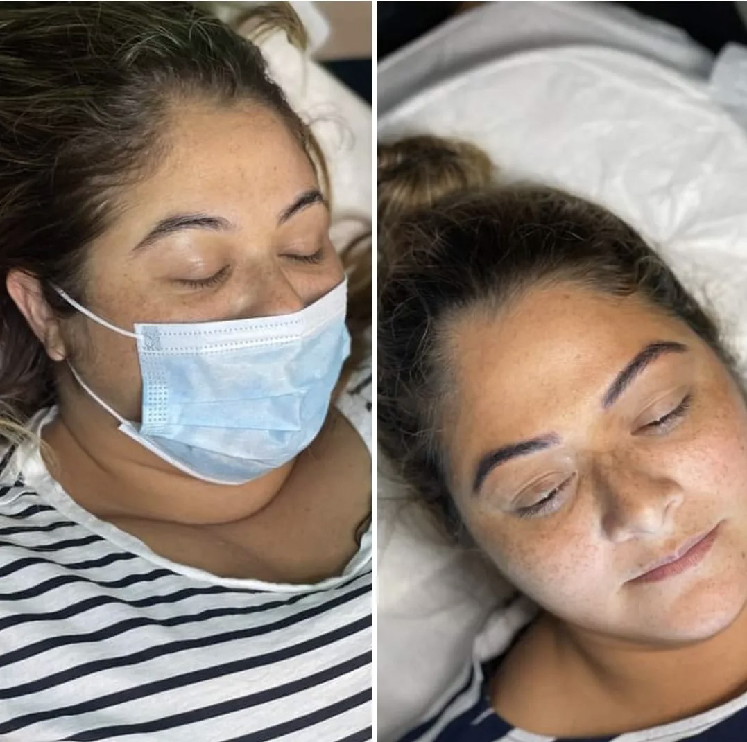 Before and after brows