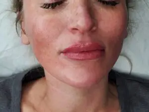 after,Permanent,Makeup,lip,blush