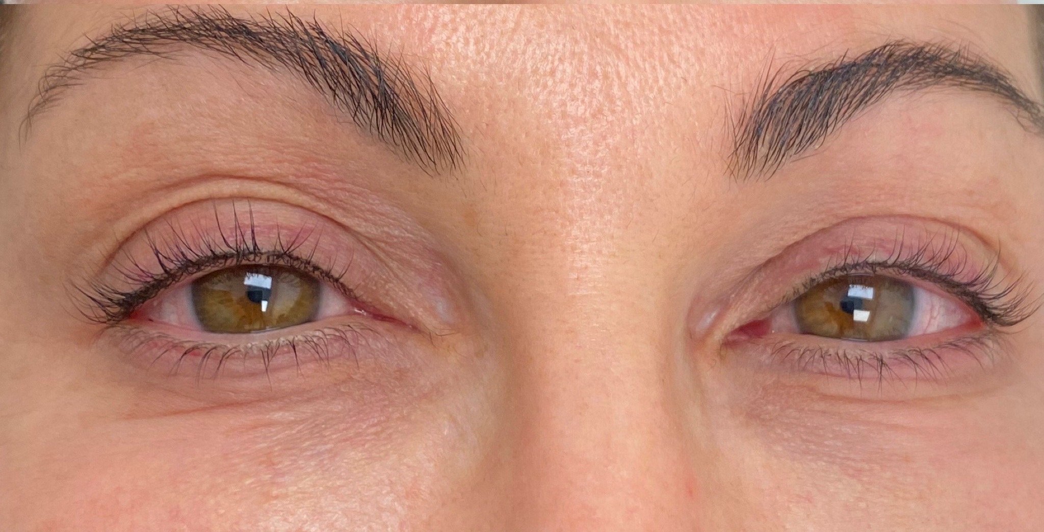 Permanent eyeliner enhancement